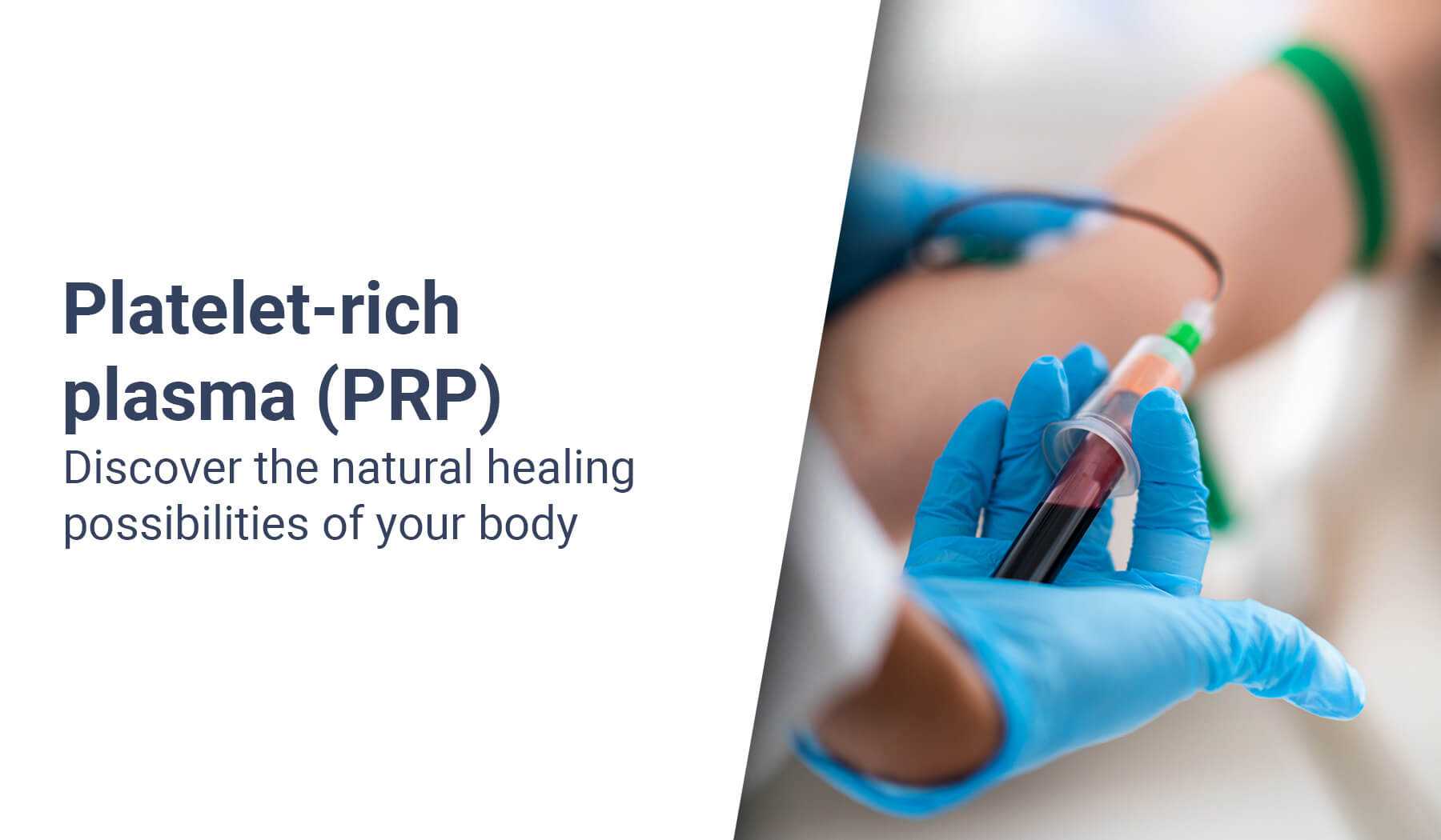 Platelet-rich plasma